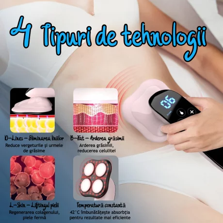 Aparat de Masaj Anticelulitic Profesional 4 in 1 VENTLEX, Remodelare coporala, Impulsuri electrice, Radiofrecventa, terapie cu lumina rosie si functie de caldura, portabil, 3 Moduri de masaj, 10 trepte de Intensitate, Alb