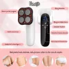 Aparat de Masaj Anticelulitic Profesional 4 in 1 VENTLEX, Remodelare coporala, Impulsuri electrice, Radiofrecventa, terapie cu lumina rosie si functie de caldura, portabil, 3 Moduri de masaj, 10 trepte de Intensitate, Alb